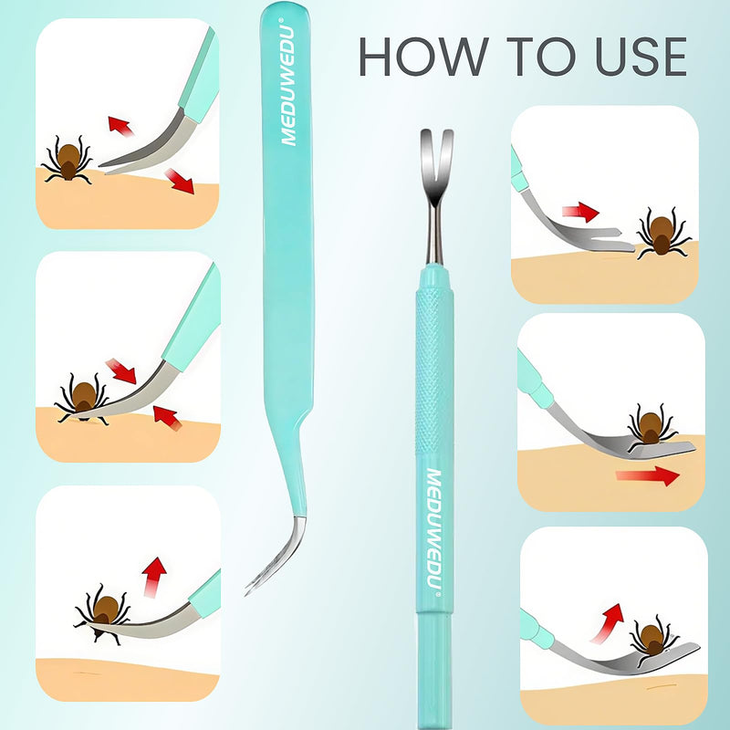 MEDUWEDU Tick Removal Tool Kit for Dogs, Cats & Humans – Stainless Steel Tick Tweezer, Fork & Dual-Head Clamp with Leather Pouch, Safe & Easy Tick Remover for Pets, Ideal for Grooming & Outdoor Travel