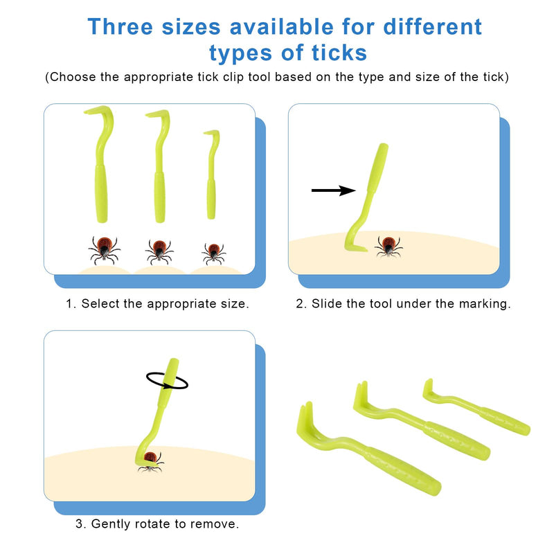 Penitue Tick Removal Tool Kit Tweezers for Cats and Dogs, Professional Portable Tick Remover and Puller Set Suitable for Dogs Cats Pets & Humans