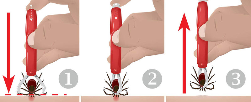 valonic tick Remover, 2 Pack - red, tick Removal Tool - tick Remover for Dogs and Cats - PawsPlanet Australia