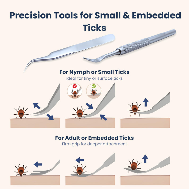 Complete Tick Removal Kit for Dogs & Cats – Tick Remover Tool Set with 3 Size Hooks, Tick Comb & Stainless Steel Precision Tick Remover + Tweezers, Travel Pouch – Safe, Fast Tick Removal