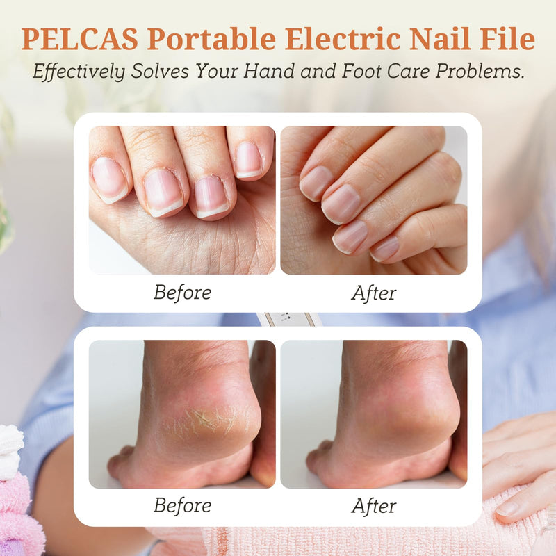 PELCAS Electric Toenail Grinder for Thick Toenails, 5 Speeds Manicure and Pedicure Kit, Cordless Nail Drill with LED Light, Electric Nail File for Human, Pet, Thick Toenails, Natural & Acrylic Nails Gold - PawsPlanet Australia