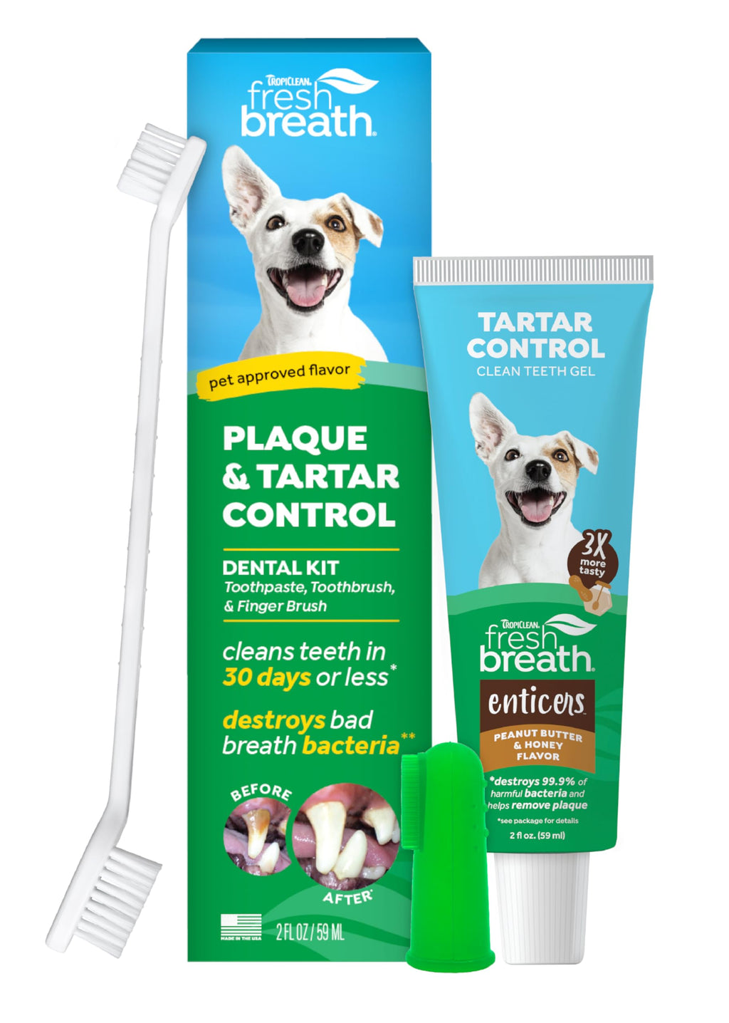 TropiClean Fresh Breath Plaque & Tartar Control Kit | Dog Toothpaste, Toothbrush & Finger Brush | Dog Toothbrushing Kit | Peanut Butter Flavor