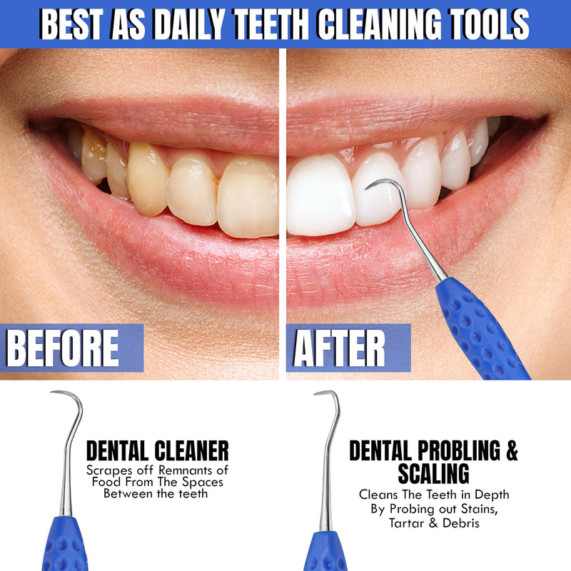 Professional Dental Tools Tartar Scraper For Dentist, Personal and Pets Use Plaque Remover With Comfortable Grip, Double ended Silicon Grip Scaler - PawsPlanet Australia