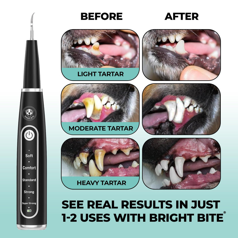 BRIGHT BITE™ | Ultrasonic Plaque Remover for Teeth | Dog Toothbrush; Cat Toothbrush | Quiet Tartar Remover | Dog Accessories | Teeth Cleaning Tools| Doggie Dental Scaler | Dental Tools | USB-C - PawsPlanet Australia