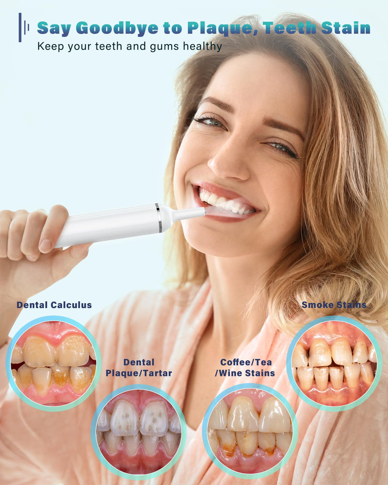 Wagner Stern Dog Plaque Remover for Teeth, Dog Toothbrush with 5 Modes & LED Light for Calculus and Stains Removal ultrasonic Pet Teeth Cleaning, Dental Care kit with 4 Heads White