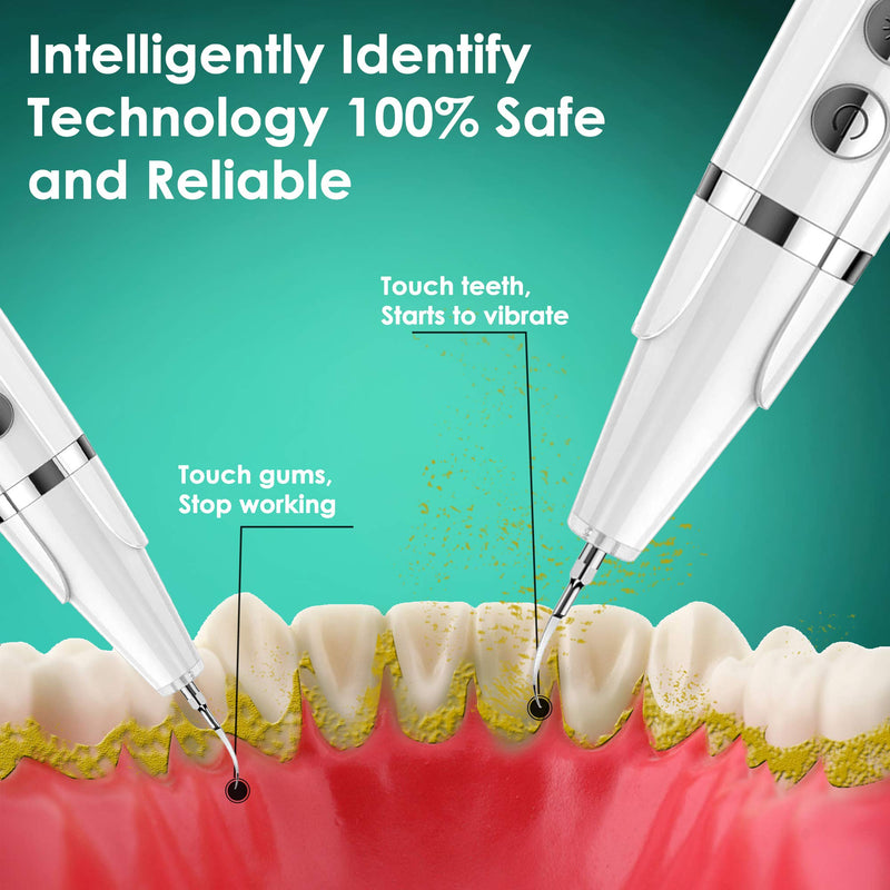 Plaque Remover for Teeth - Pet Ultrasonic Toothbrush Cleaner - Teeth Cleaning Kit for Tartar and Stains - Suitable for Dogs and Cats (White) White - PawsPlanet Australia