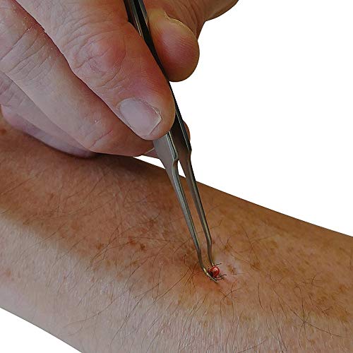 Safety First Aid Group Tick Remover Tool for Humans, Dogs & Cats - PawsPlanet Australia