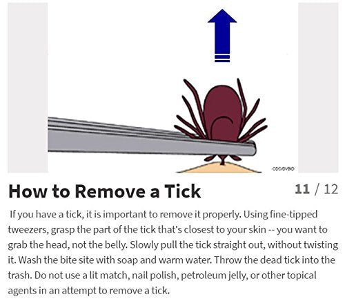 eTradewinds Tick Remover Tool | Tick-Off Pro | Hygienic All Stainless Steel Tick Removal Tool with Leather Case 1-Pack - PawsPlanet Australia