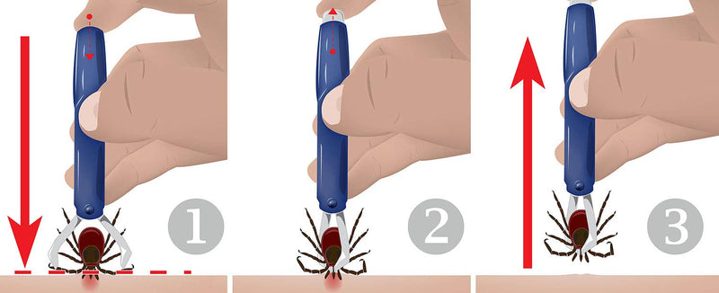 valonic tick Remover | 2 Pack | Blue | tick Removal Tool | tick Remover for Dogs and Cats - PawsPlanet Australia