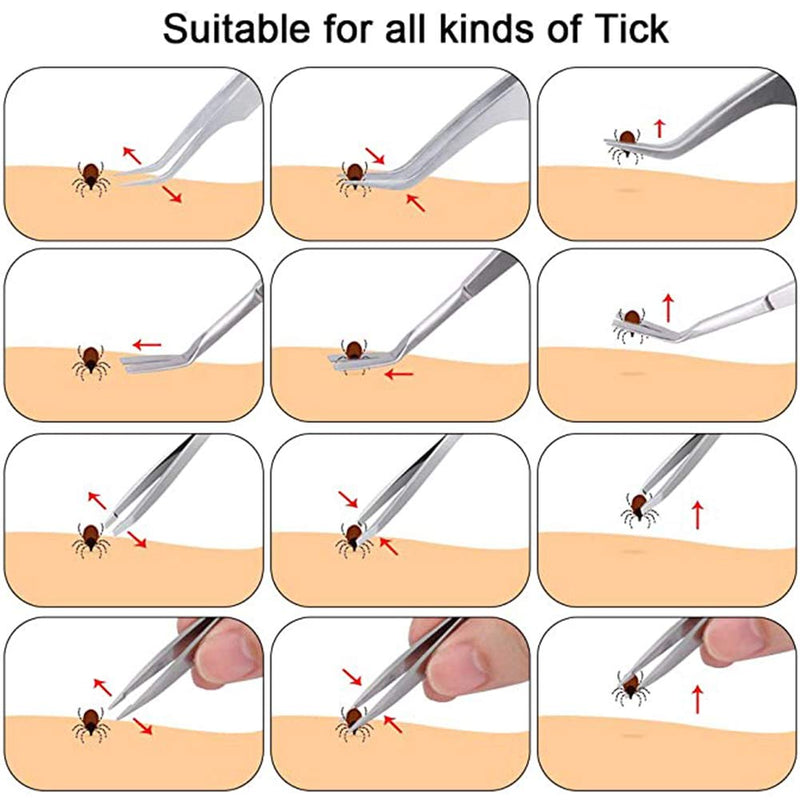 Premium Tick Remover Tool Set, Stainless Steel tick removal Kit for Humans, Dogs, Cats - PawsPlanet Australia