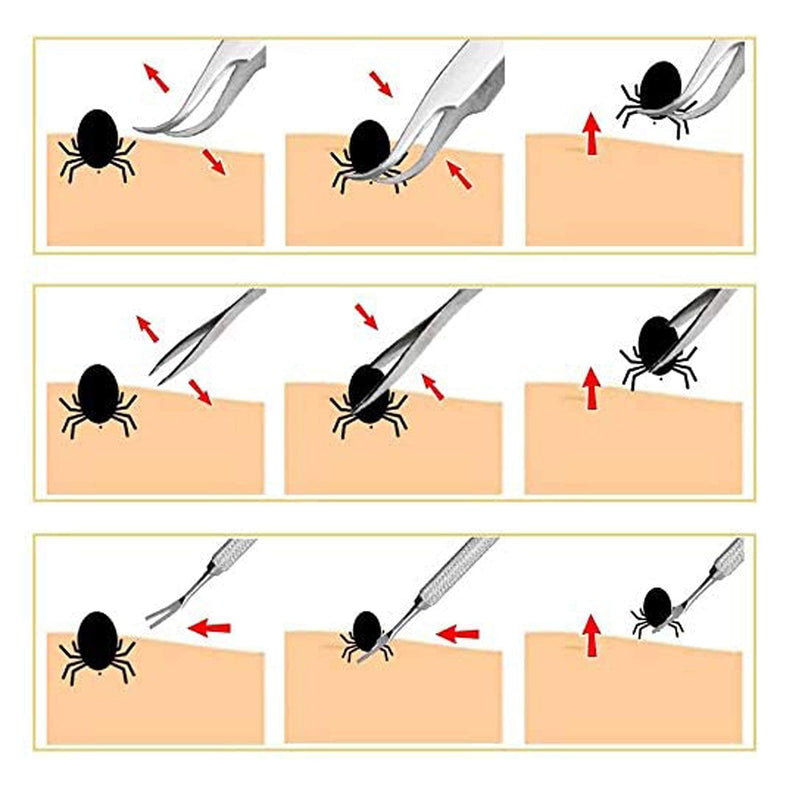 AFTREN Professional Tick Remover Pet Care Tool Set for Dogs/Cats/Horses/Humans 3PCS Stainless Steel Fleas Ticks Remover Kit with Storage - PawsPlanet Australia