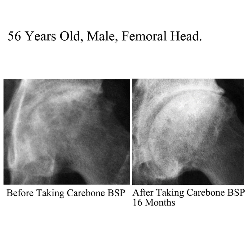 Carebone Bone-Strengthening Supplement BSP for Bone Joint Cartilage Muscle Tissue Health 30 Tablets - PawsPlanet Australia